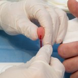 Sellest aastast saab kindlustamata isikutele teha vältimatu abi raames HIV-testi