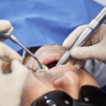 Hammaste siirdamine - hamba asendamise alternatiiv implantaatile