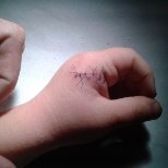 ISA ŠOKK: kolmeaastane laps lõi teisele paberinoa kätte