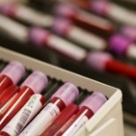 Laskesuusataja meenutab inimkatseid: veredoping andis suusarajal tohutu eelise