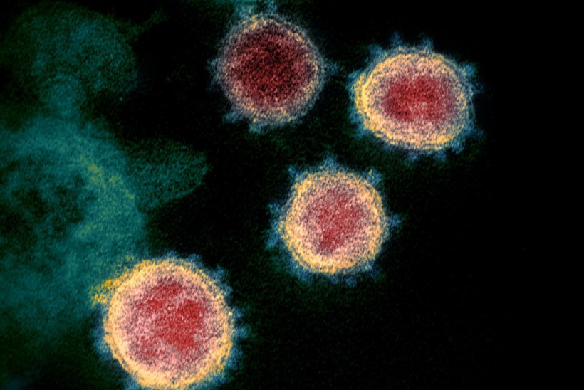 UUS UURING: Norra teadlase väitel loodi koroonaviirus laboris