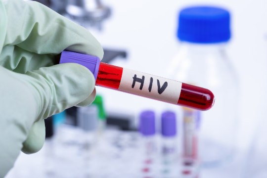Oktoobris on HIV leitud juba viiel inimesel