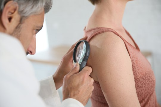 Vägagi levinud melanoomi avastatakse järjest enam õigeaegselt
