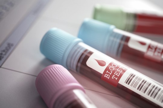 TERVISESPORTLASTELE: milliseid verenäite uue aasta alguses kontrollida?