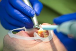 Lugejakiri | Murdunud hammas ja eriolukorras saadud kummaline hambaravi