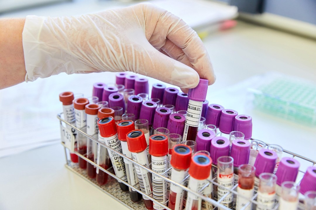 TASUTA TESTIMISNÄDAL! Tervise arengu instituut kutsub inimesi üles HIV-testi tegema